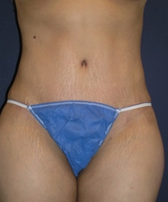 After Image