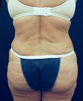 After Image