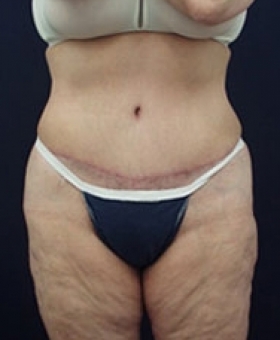 After Image