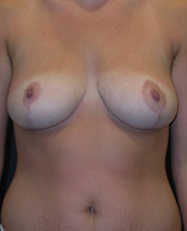 After Image