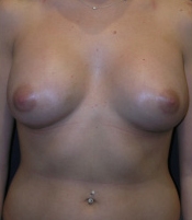 After Image