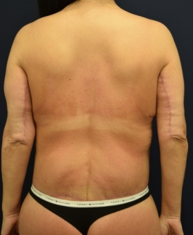 After Image