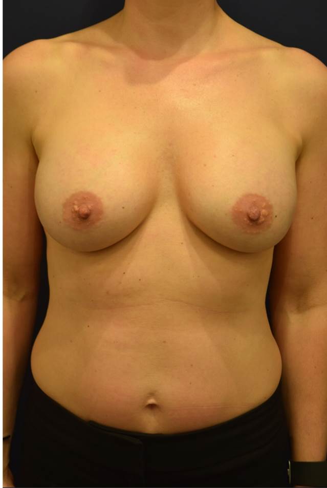 After Image
