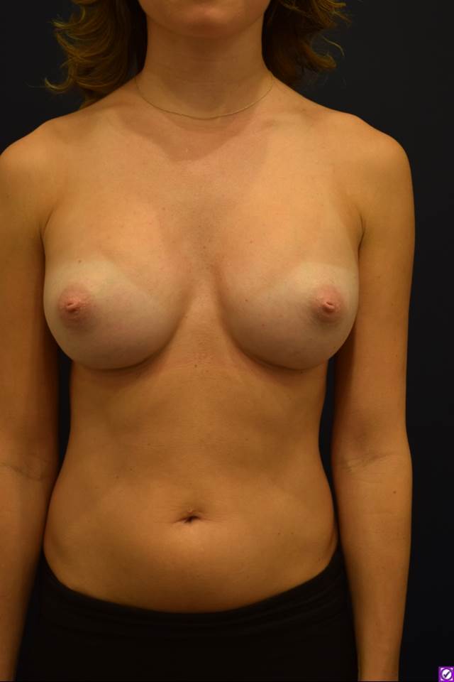 After Image