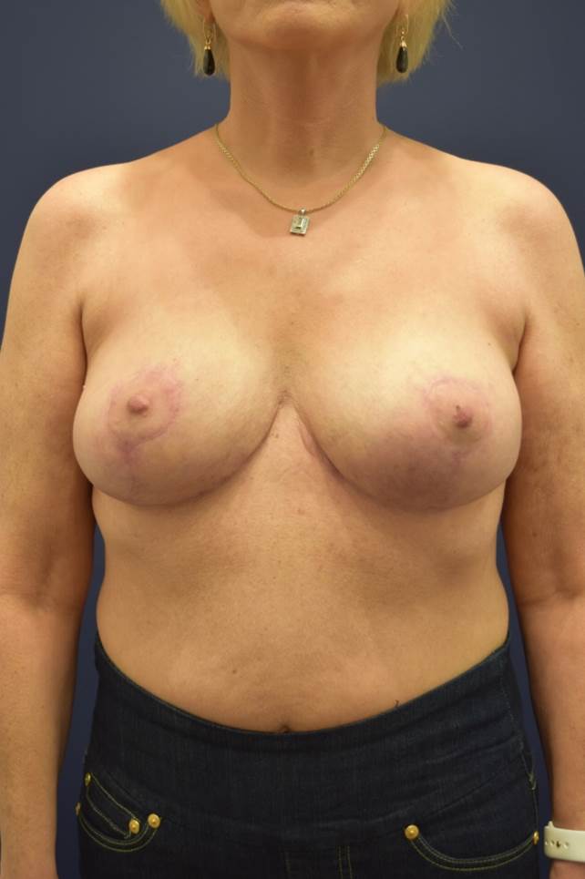 After Image