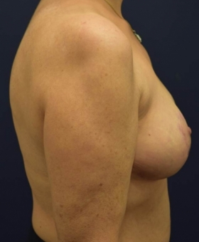 After Image
