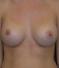 After Image