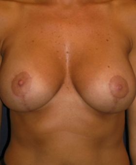 After Image