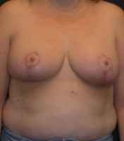 After Image