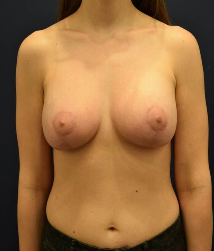 After Image