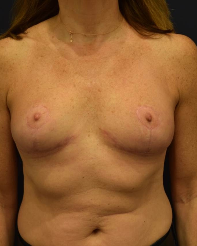 After Image