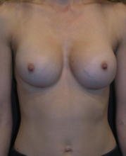 After Image