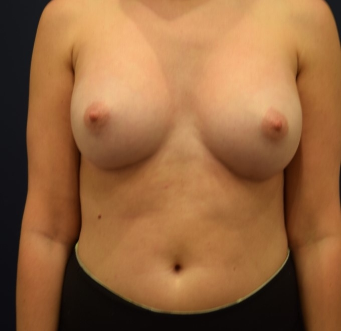 After Image
