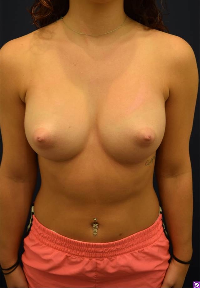 After Image