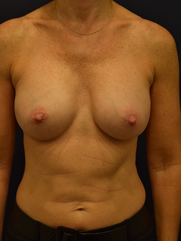 After Image