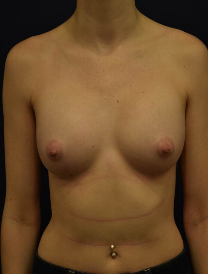 After Image