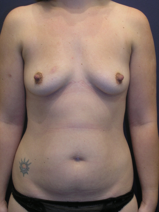 Before Image