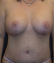 After Image