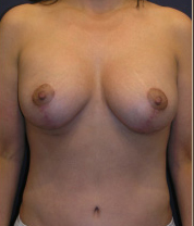 After Image