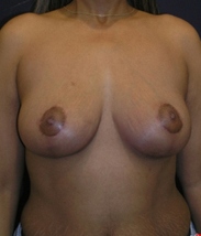 After Image