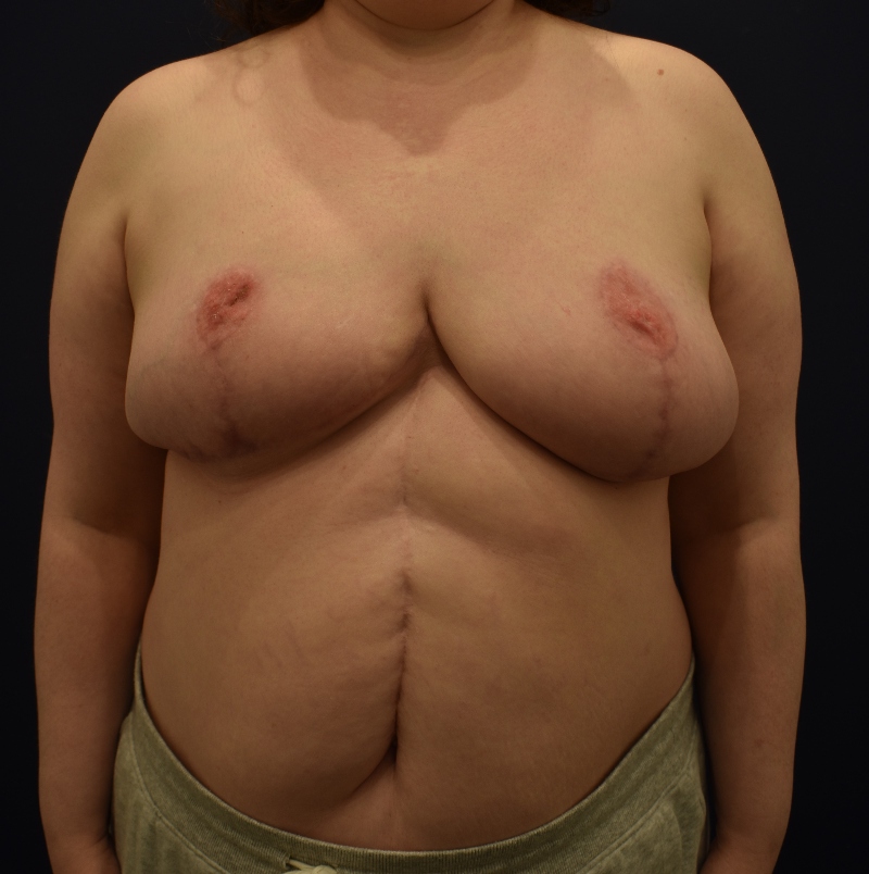 After Image