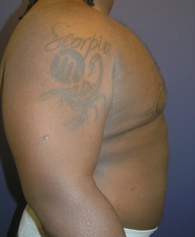 After Image