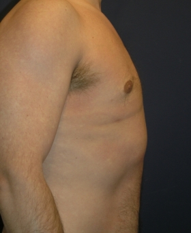 After Image