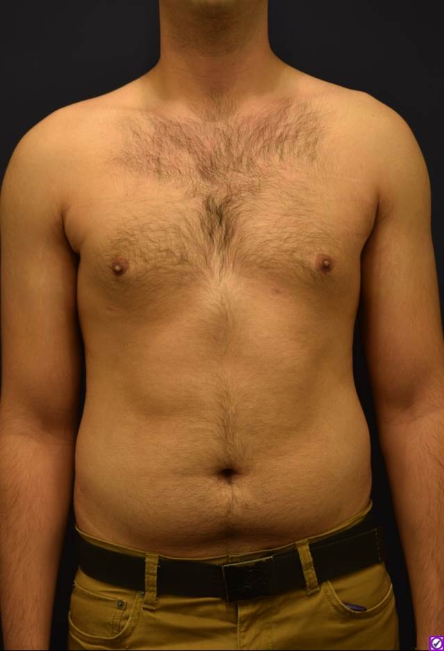 After Image