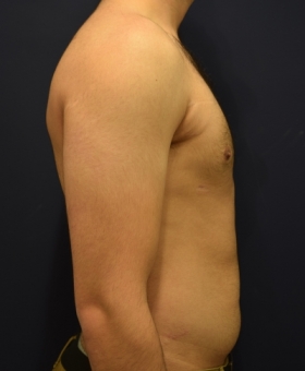 After Image