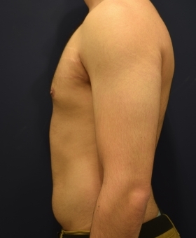 After Image