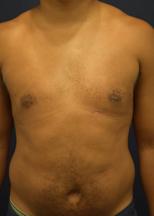 After Image