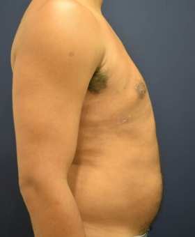 After Image