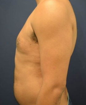 After Image