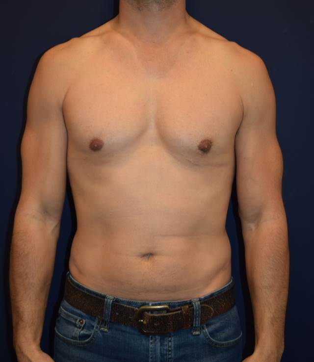 After Image