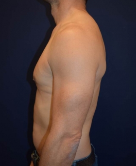 After Image