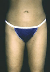 After Image