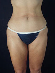 After Image