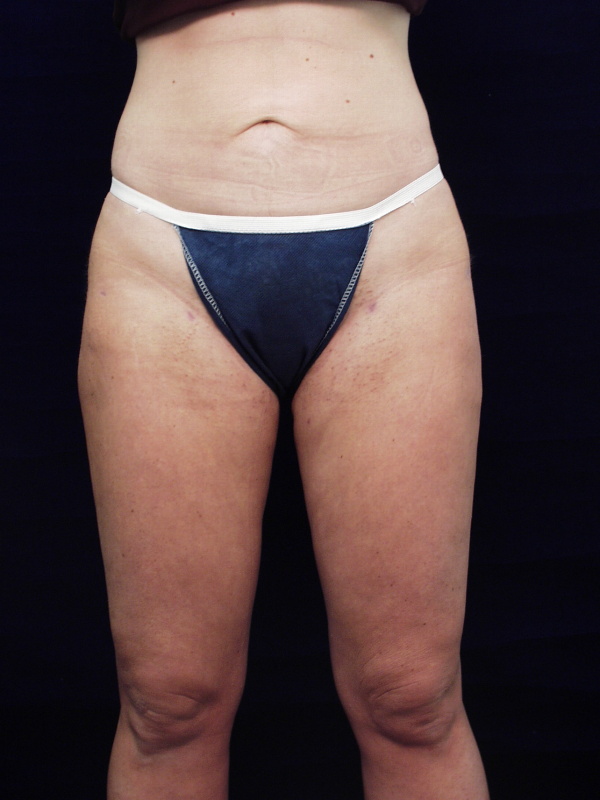 After Image