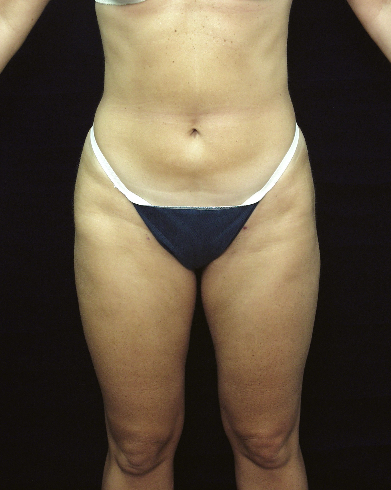 After Image