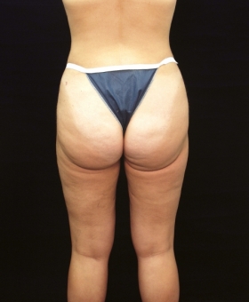 After Image