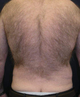 After Image