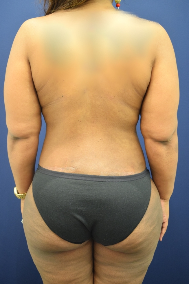 After Image