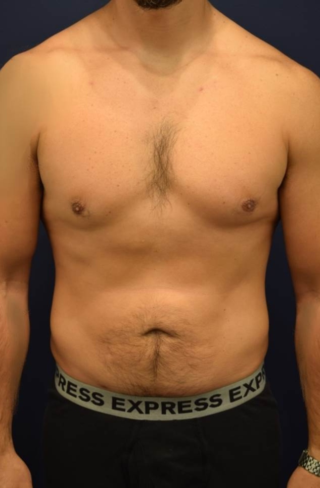 After Image