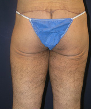 After Image