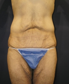 Before Image