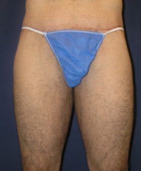 After Image