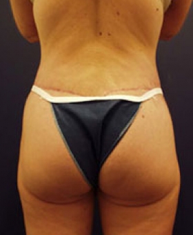 After Image
