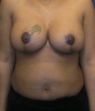 After Image